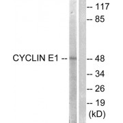 Western blot analysis of extracts from HeLa cells, treated with Paclitasel (1 µM, 60mins), using Cyclin E1 antibody.  The lane on the right is blocked with the synthesised peptide.