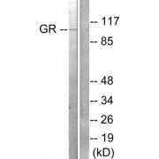 Western blot analysis of extracts from HeLa cells treated with PMA (125ng/ml, 30min), using GR (epitope around residue 211) antibody (abx012759, Line 1 and 2).