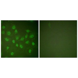 DNA-Directed RNA Polymerase II Subunit RPB1 (POLR2A) Antibody