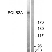 Western blot analysis of extracts from COS7 cells treated with EGF (200ng/ml, 30min), using POLR2A (epitope around residue 1619) antibody (abx012764, Line 1 and 2).