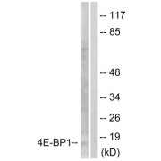 Western blot analysis of extracts from Jurkat cells, treated with Insulin (0.01U/ml, 15mins), using 4E-BP1 (epitope around residue 64) antibody.