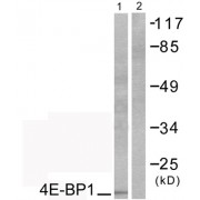 Western blot analysis of extracts from COS7 cells, treated with EGF (200ng/ml, 30mins), using 4E-BP1 (epitope around residue 69) antibody (abx012768).