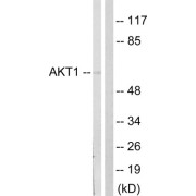 Western blot analysis of extracts from NIH/3T3cells, treated with PDGF (50mg /ml, 20mins), using Akt (epitope around residue 124) Antibody.