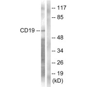 Western blot analysis of extracts from COS7 cells, treated with Serum (10%, 30mins), using CD19 (epitope around residue 531) Antibody.