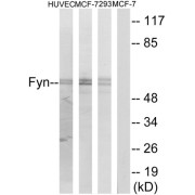 Western blot analysis of extracts from HUVEC cells, MCF-7 cells and 293 cells, using Fyn (epitope around residue 530) antibody.