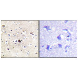 Glutathione Reductase (GSR) Antibody
