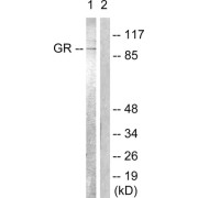 Western blot analysis of extracts from Jurkat cells, treated with EGF (200ng/ml, 15mins), using GSR (epitope around residue 226) antibody (abx012772).