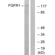 Western blot analysis of extracts from HepG2 cells, using FGFR1 (epitope around residue 766) antibody.