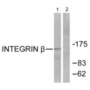 Western blot analysis of extracts from Jurkat cells, using Integrin beta 1 (epitope around residue 789) antibody.