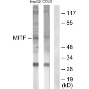 Western blot analysis of extracts from HepG2 cells (lane 1) and COLO205 cells (lane 2), using MITF (epitope around residue 180/73) antibody.