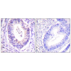 90 kDa Ribosomal Protein S6 Kinase 1 (p90 RSK) Antibody