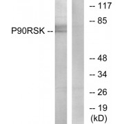Western blot analysis of extracts from 3T3 cells, treated with PMA (125ng/ml, 30mins), using p90 RSK (epitope around residue 573) antibody.