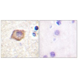 Platelet Endothelial Cell Adhesion Molecule (PECAM-1) Antibody