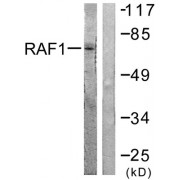 Western blot analysis of extracts from HeLa cells, treated with UV (5mins), using Raf1 (epitope around residue 621) antibody.