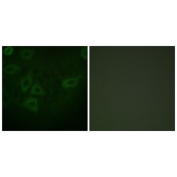 Thymidine Kinase (TK) Antibody
