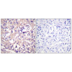 Thymidine Kinase (TK) Antibody