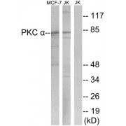 Western blot analysis of extracts from MCF-7 cells and Jurkat cells, using PKC alpha (epitope around residue 657) antibody.