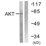Western blot analysis of extracts from NIH/3T3 cells, treated with Insulin (0.01U/ml, 15mins), using Akt (epitope around residue 326) antibody.