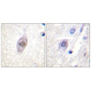 Immunohistochemistry analysis of paraffin-embedded human brain tissue, using APC antibody.