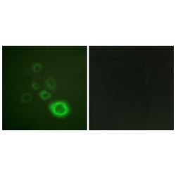 Hepatocyte Growth Factor Receptor (c-Met) Antibody