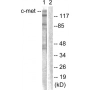 Western blot analysis of extracts from HepG2 cells, using c-Met (epitope around residue 1003) antibody.