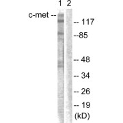 Western blot analysis of extracts from HepG2 cells, using c-Met (epitope around residue 1003) antibody.