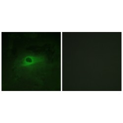 Macrophage Colony-Stimulating Factor 1 Receptor (CSF1R) Antibody