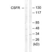 Western blot analysis of extracts from HT-29 cells, using CSFR (epitope around residue 809) antibody.