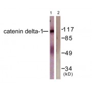 Western blot analysis of extracts from HuvEc cells, using Catenin- delta 1 (epitope around residue 228) antibody.