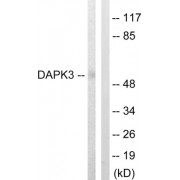 Western blot analysis of extracts from HuvEc cells, using DAPK3 (epitope around residue 265) antibody.