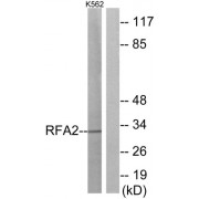 Western blot analysis of extracts from K562 cells, using RFA2 (epitope around residue 21) antibody.