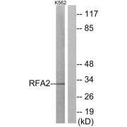 Western blot analysis of extracts from K562 cells, using RFA2 (epitope around residue 21) antibody.