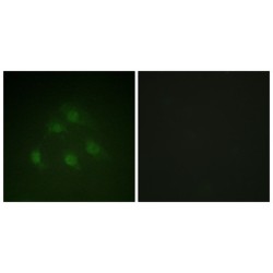 Mothers Against Decapentaplegic Homolog 1 (Smad1) Antibody