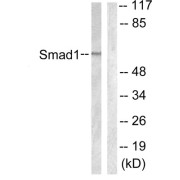 Western blot analysis of extracts from 293 cells, using Smad1 (epitope around residue 187) antibody.