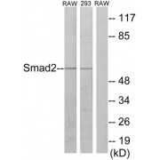 Western blot analysis of extracts from RAW264.7 cells and 293 cells, using Smad2 (epitope around residue 220) antibody.