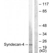 Western blot analysis of extracts from HepG2 cells, using Syndecan4 (epitope around residue 179) antibody.