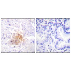 Interleukin 2 Receptor Beta (IL2RB) Antibody