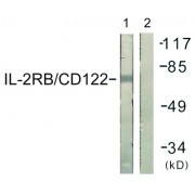 Western blot analysis of extracts from COS7 cells, using IL-2R beta /CD122 (epitope around residue 364) antibody.