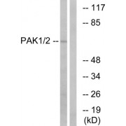 Western blot analysis of extracts from K562 cells, using PAK1/2 (epitope around residue 199) antibody.