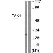 Western blot analysis of extracts from HepG2 cells, using TAK1 (epitope around residue 184) antibody.