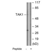 WB analysis of HepG2 cells, using TAK1 antibody. The lane on the right was treated with the corresponding peptide.