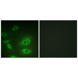 ATP1 alpha 1 / Na+K+ ATPase1 Antibody