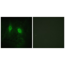 Inhibitor of Nuclear Factor Kappa-B Kinase Subunit Gamma (IKK gamma) Antibody