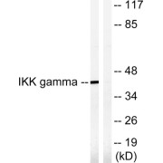 Western blot analysis of extracts from HepG2 cells, treated with Anisomycin (0.5uM, 5hours), using IKK- gamma (epitope around residue 85) antibody.