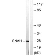 Western blot analysis of extracts from HT29 cells, using SNAI1 antibody.