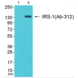 Insulin Receptor Substrate 1 (IRS-1) Antibody
