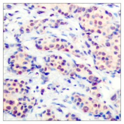 Transcription Factor JunD (JUND) Antibody