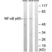 Western blot analysis of extracts from K562 cells and Raw264.7 cells, using NF-kappaB p65 Antibody (epitope around residue 276). The lane on the right is blocked with the synthesized peptide.