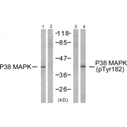 Western blot analysis of extracts from K562 cells, untreated or treated with UV, using P38 MAPK (epitope around residue 182) antibody (Line 1 and 2) and P38 MAPK (Phospho-Tyr182) antibody (Line 3 and 4).