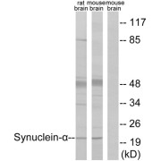 Western blot analysis of extracts from rat brain and mouse brain, using Synuclein-alpha antibody. The lane on the right is treated with the synthesized peptide.